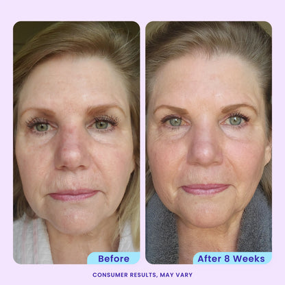 Erase Wrinkles & Restore Youthful Elasticity Over-Night