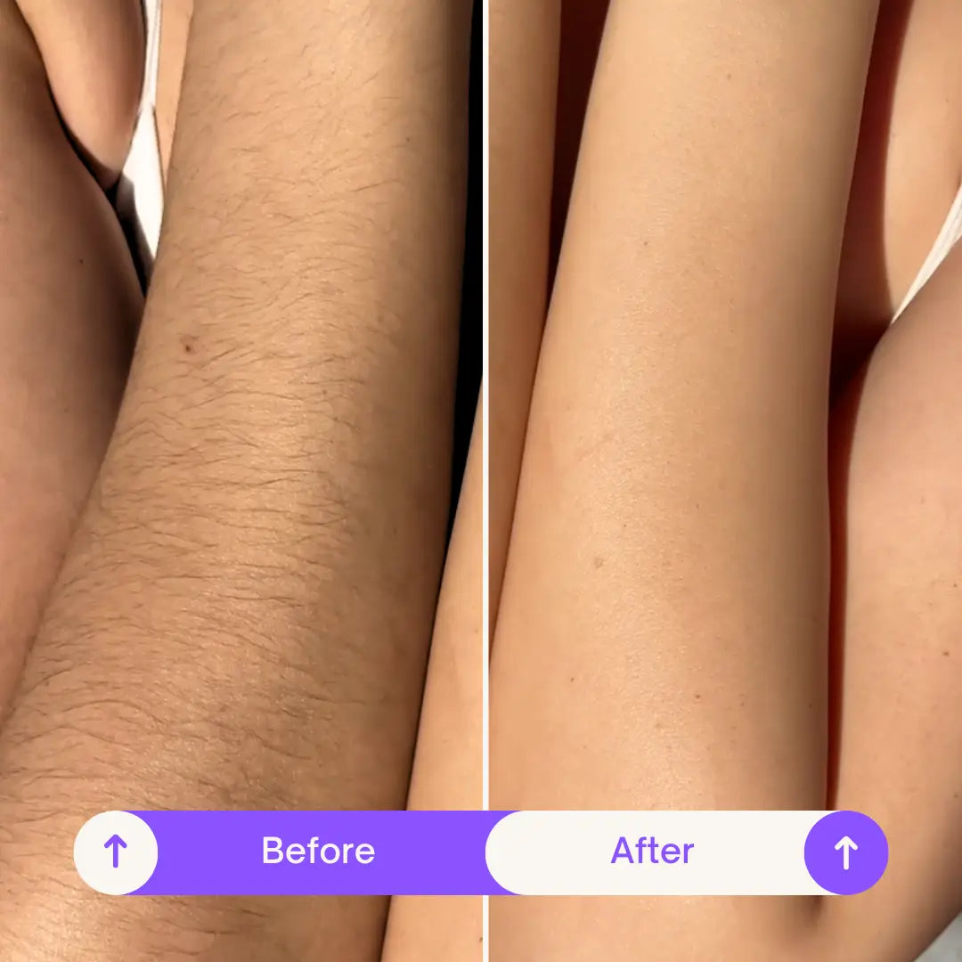 7-Day SilkSkin Smooth Body Hair Removal Cream
