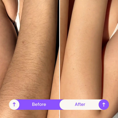 7-Day SilkSkin Smooth Body Hair Removal Cream