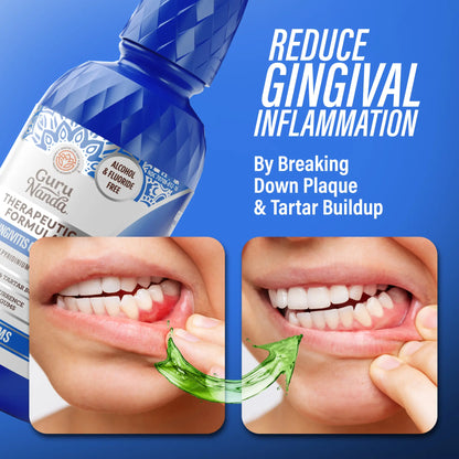 Natural Mouthwash for Complete Gum Health & Fresh Breath