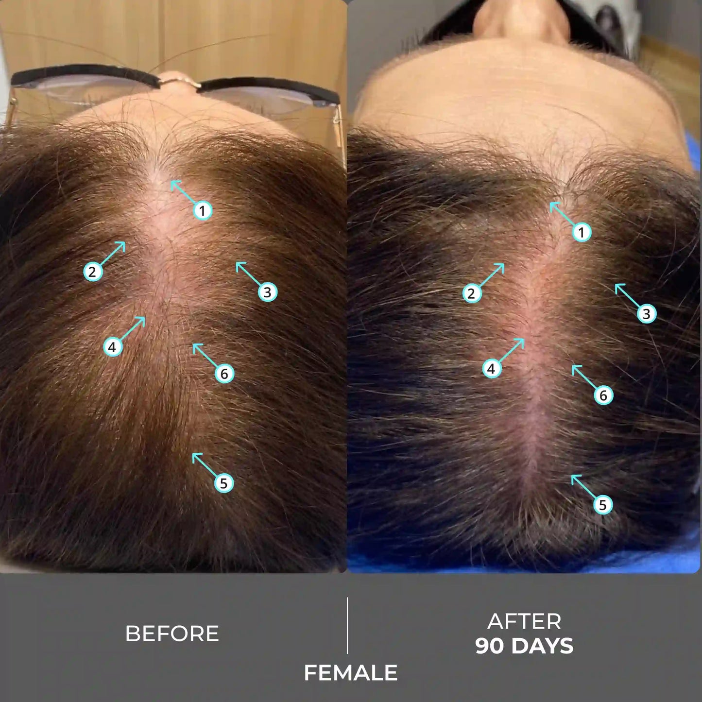 Advanced Hair Density Shampoo