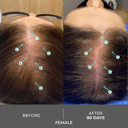 Advanced Hair Density Shampoo