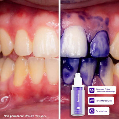 Instant Yellow Stain Remover: V34 Color Correcting Serum