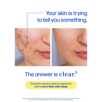 Clear Skin Acne Supplement with Zinc, DIM & Probiotics