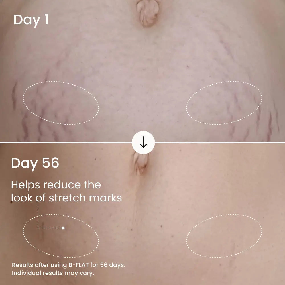 MAËLYS B-FLAT Clinically Proven Belly Firming Cream
