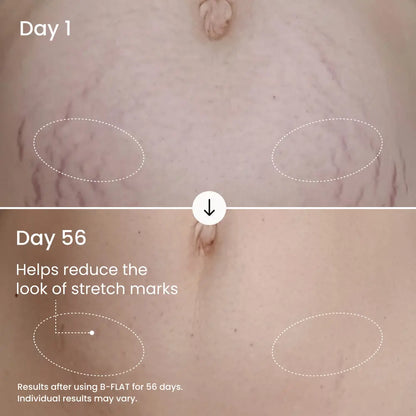 MAËLYS B-FLAT Clinically Proven Belly Firming Cream