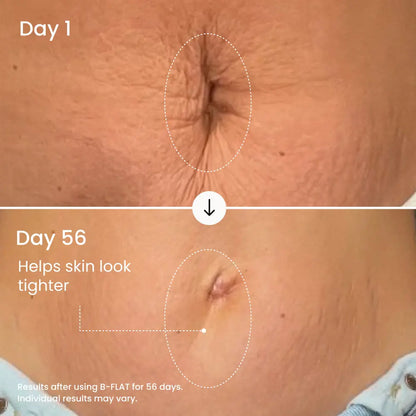 MAËLYS B-FLAT Clinically Proven Belly Firming Cream