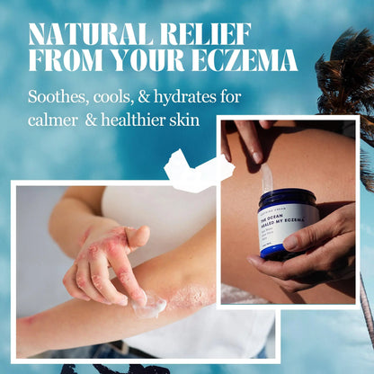 Therapeutic Eczema & Psoriasis Relief Cream with Sea Moss and Healing Oats