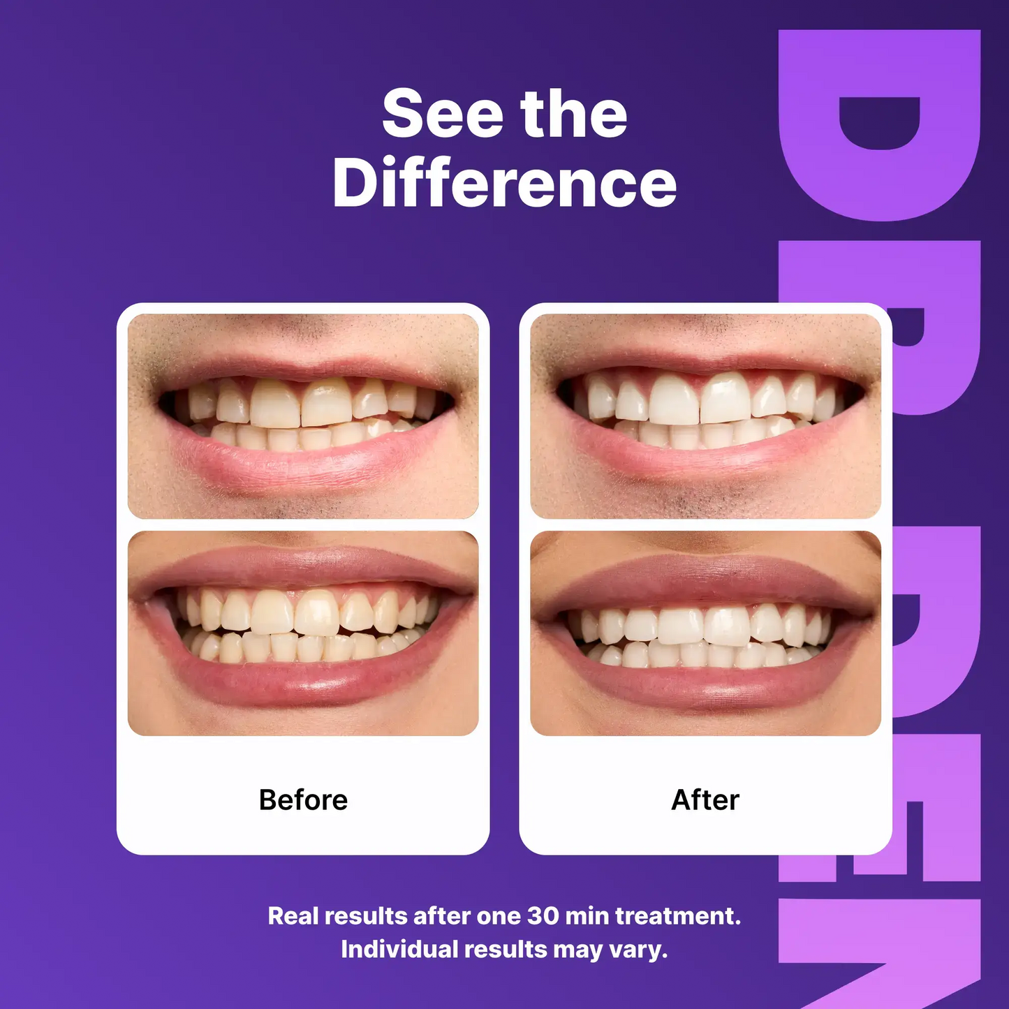 Instantly Neutralize Yellow Stains for a Brighter Smile