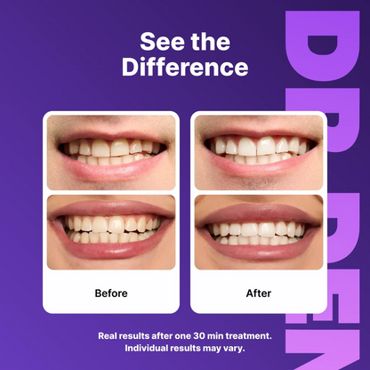 Instantly Neutralize Yellow Stains for a Brighter Smile