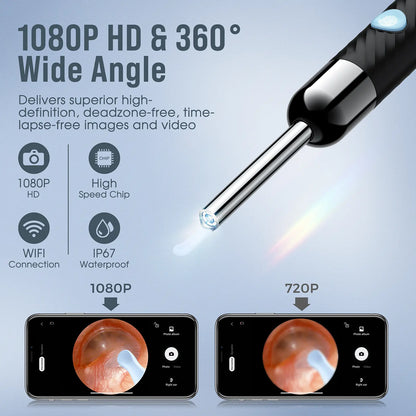 LOYKER Ear Wax Removal Tool, 1080P Ear Camera with Light